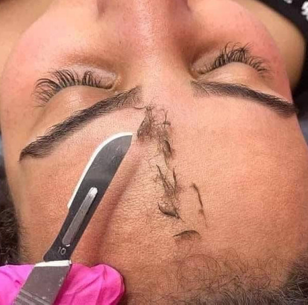 الديرما بلانينج Dermaplaning
اداة الديرما + 20 مشرط هدية