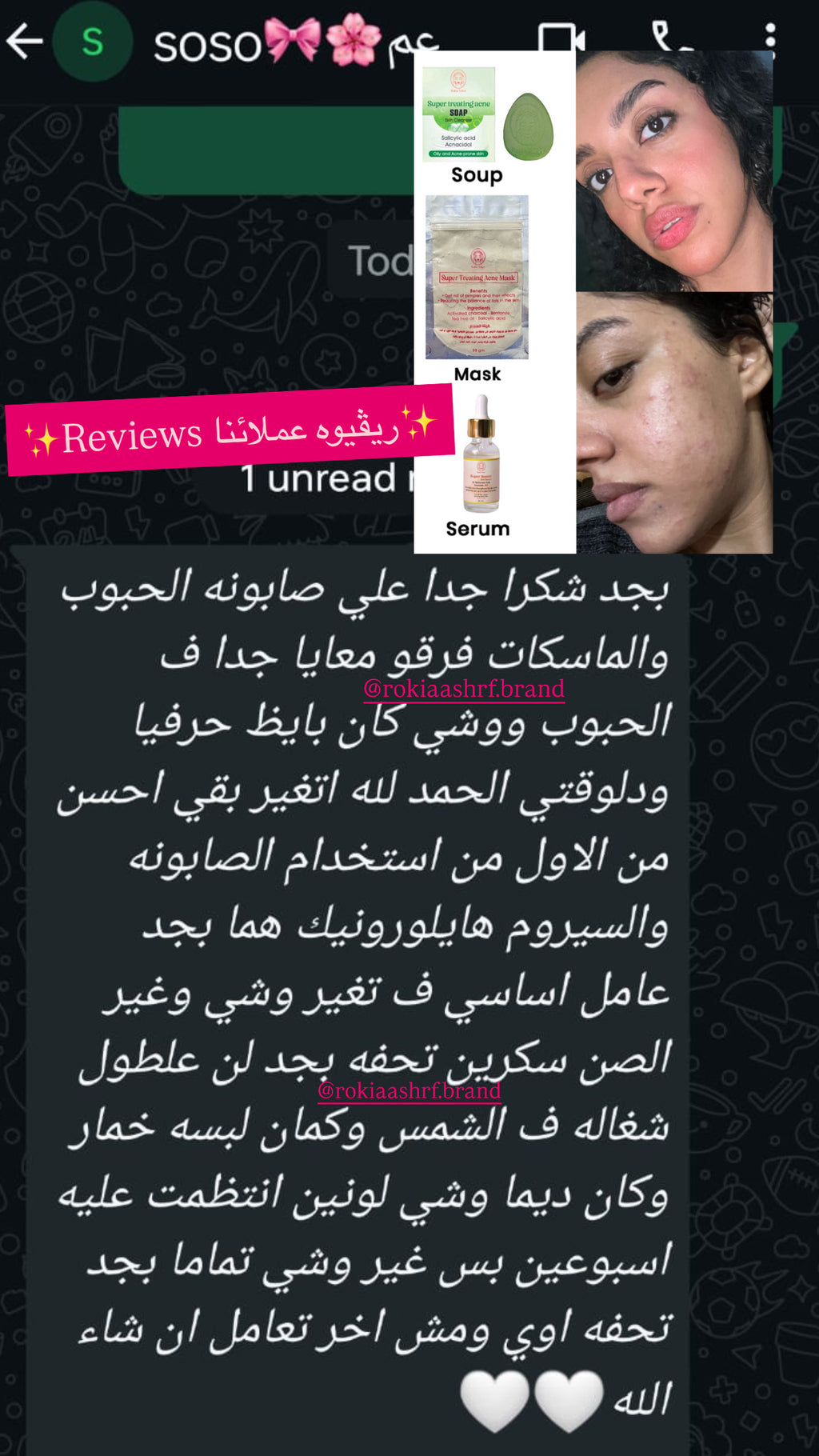 بوكس البشره الدهنيه والمخطلته لعلاج الحبوب والحد من الافرازات الدهنيه ونضارة البشرة | صابونة سوبر تريتينج اكني - ماسك سوبر تريتينج - سيروم الهايلورونيك والنياسيناميد