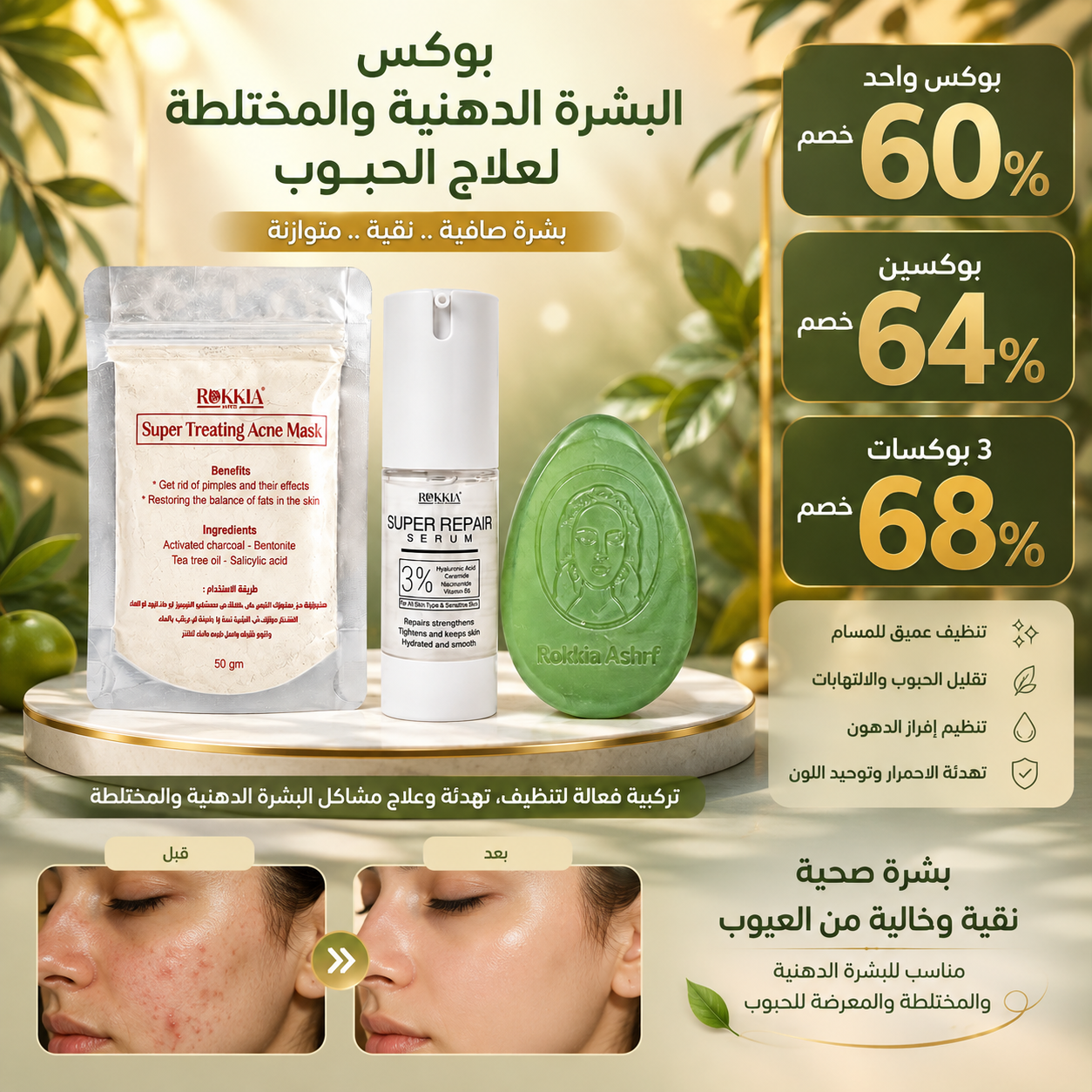 بوكس البشره الدهنيه والمخطلته لعلاج الحبوب والحد من الافرازات الدهنيه ونضارة البشرة | صابونة سوبر تريتينج اكني - ماسك سوبر تريتينج - سيروم الهايلورونيك والنياسيناميد