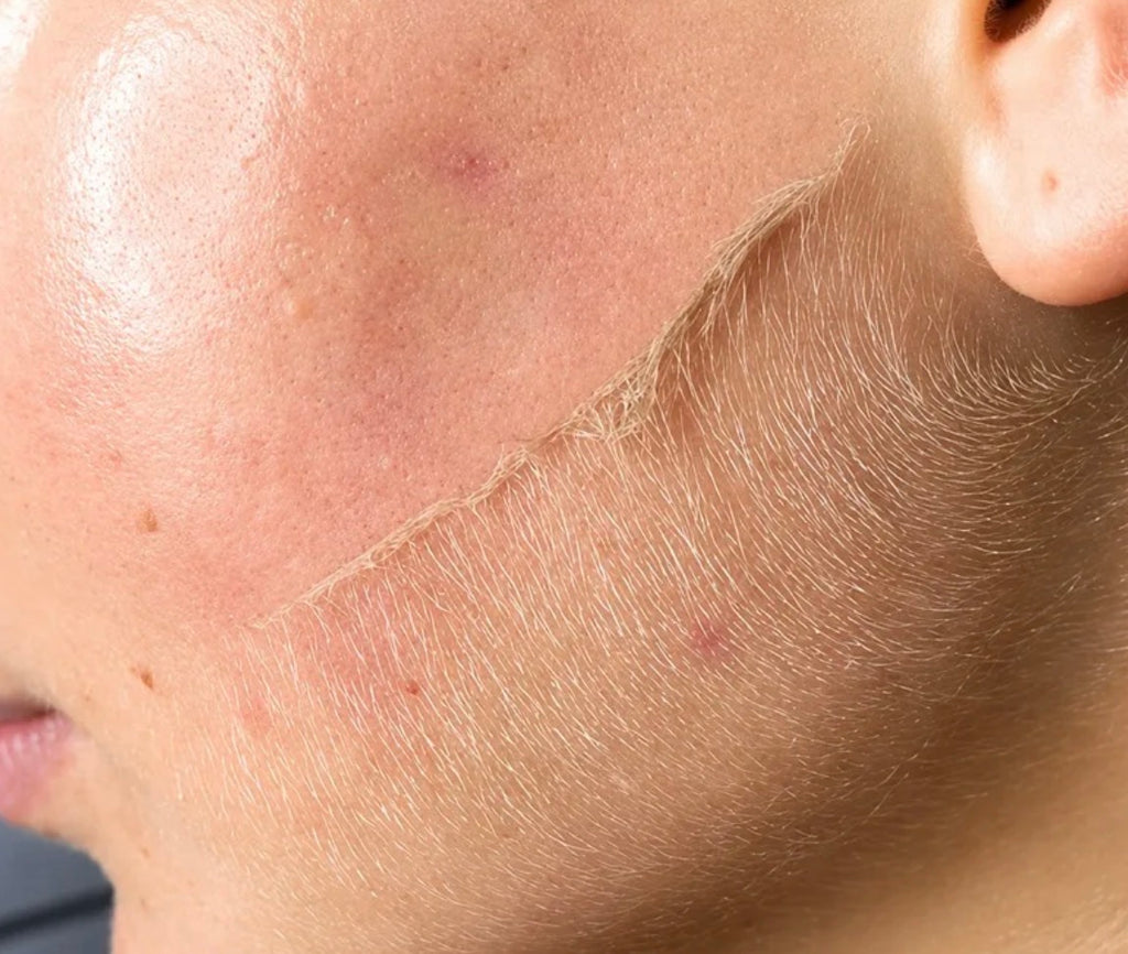 الديرما بلانينج Dermaplaning
اداة الديرما + 20 مشرط هدية