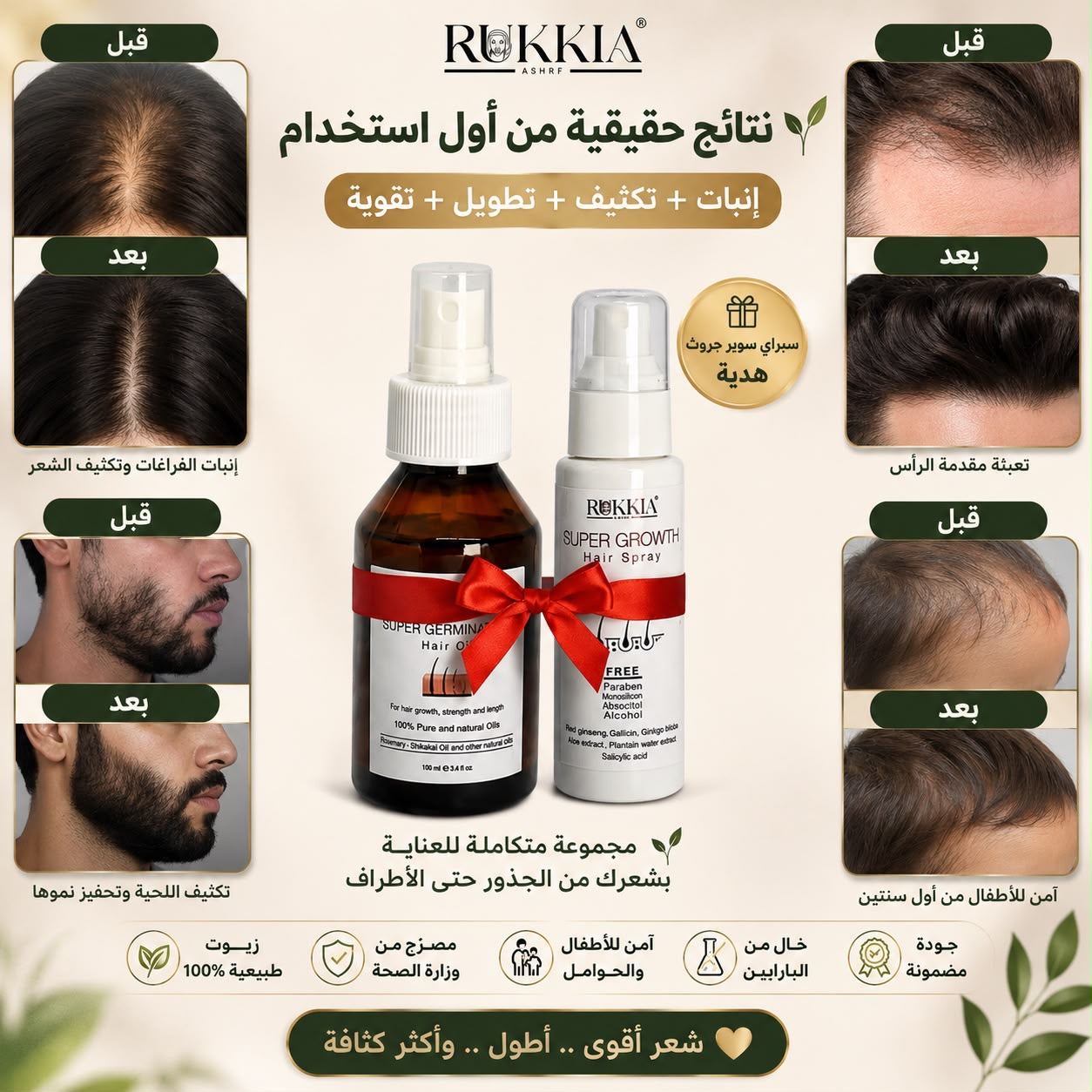 عرض الانبات والتكثيف وتطويل الشعر - عبوة حمام زيت سوبر چرمنيشن + عبوة سبراي سوبر جروث هدية خصم 50% للعبوتين 🎁